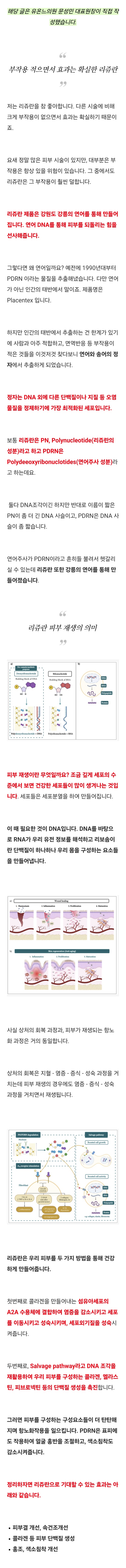 리쥬란엠보